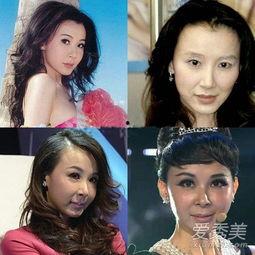 明星整容的有哪些,哪些明星曾动刀?