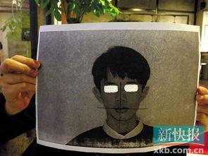 箍牙图片,箍牙前后对比，见证牙齿蜕变之旅